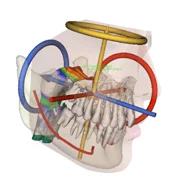 3d orthodontics 2
