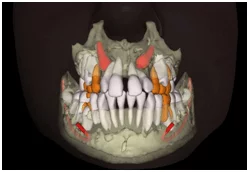 3d orthodontics 3