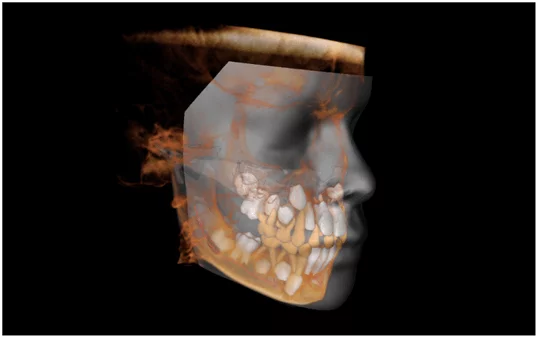 3d orthodontics 6
