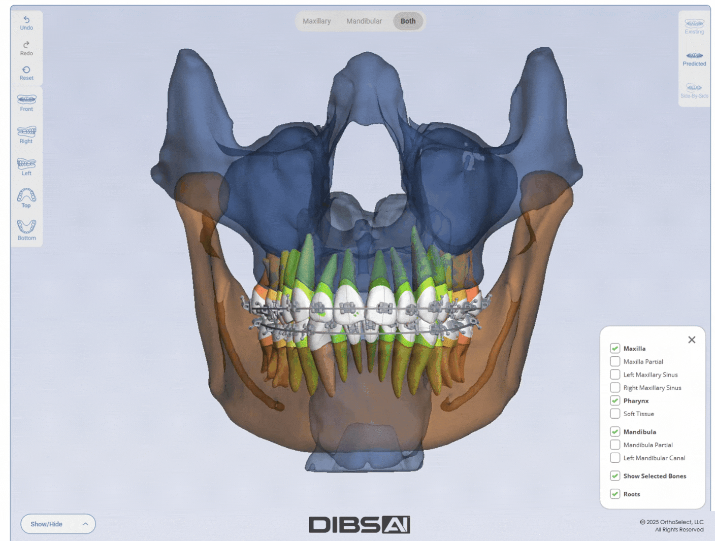 CBCT Scan GIF CBCT Scan GIF